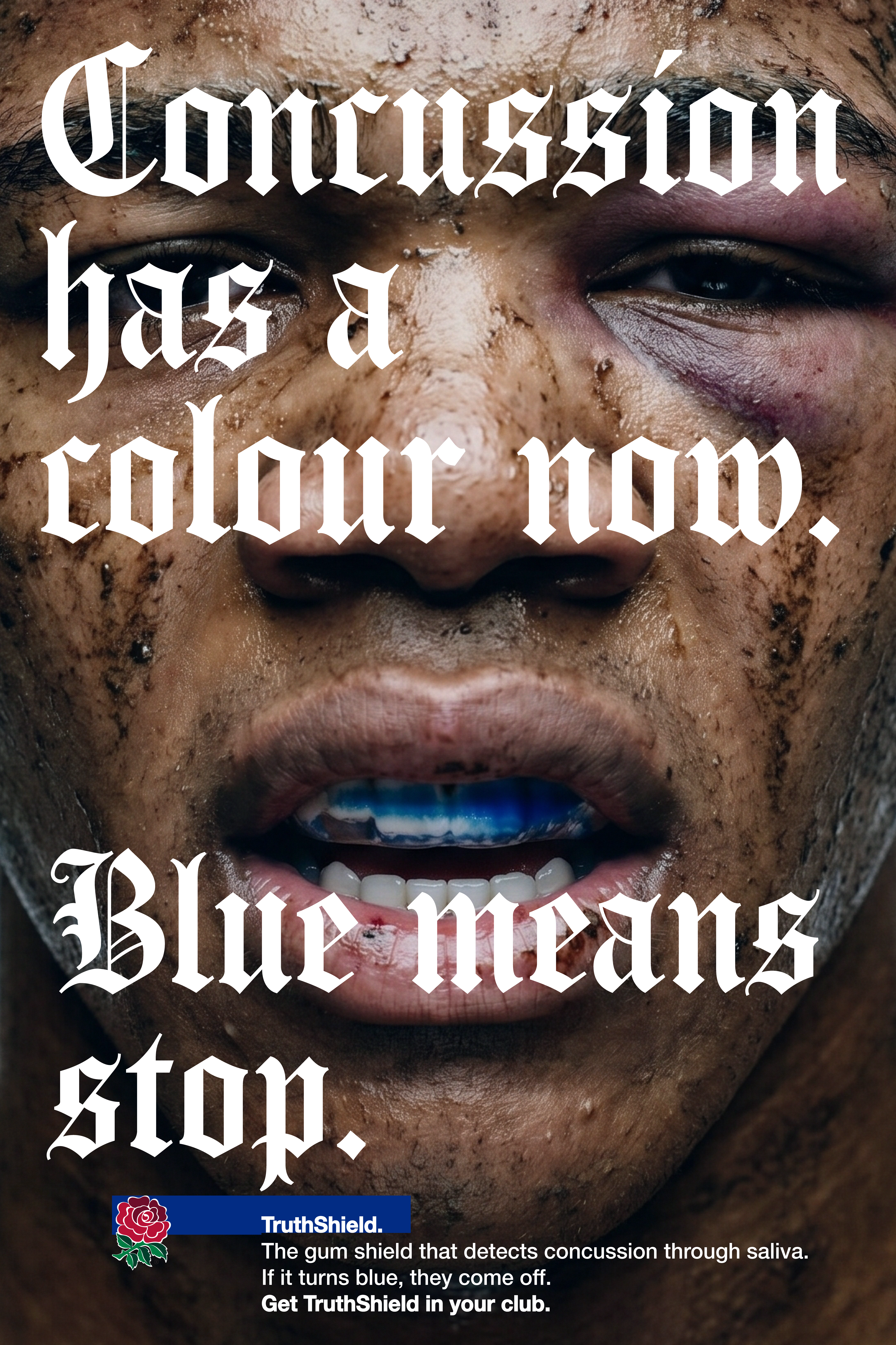 RFU TruthShield poster reading concussion has a colour now and blue means stop.