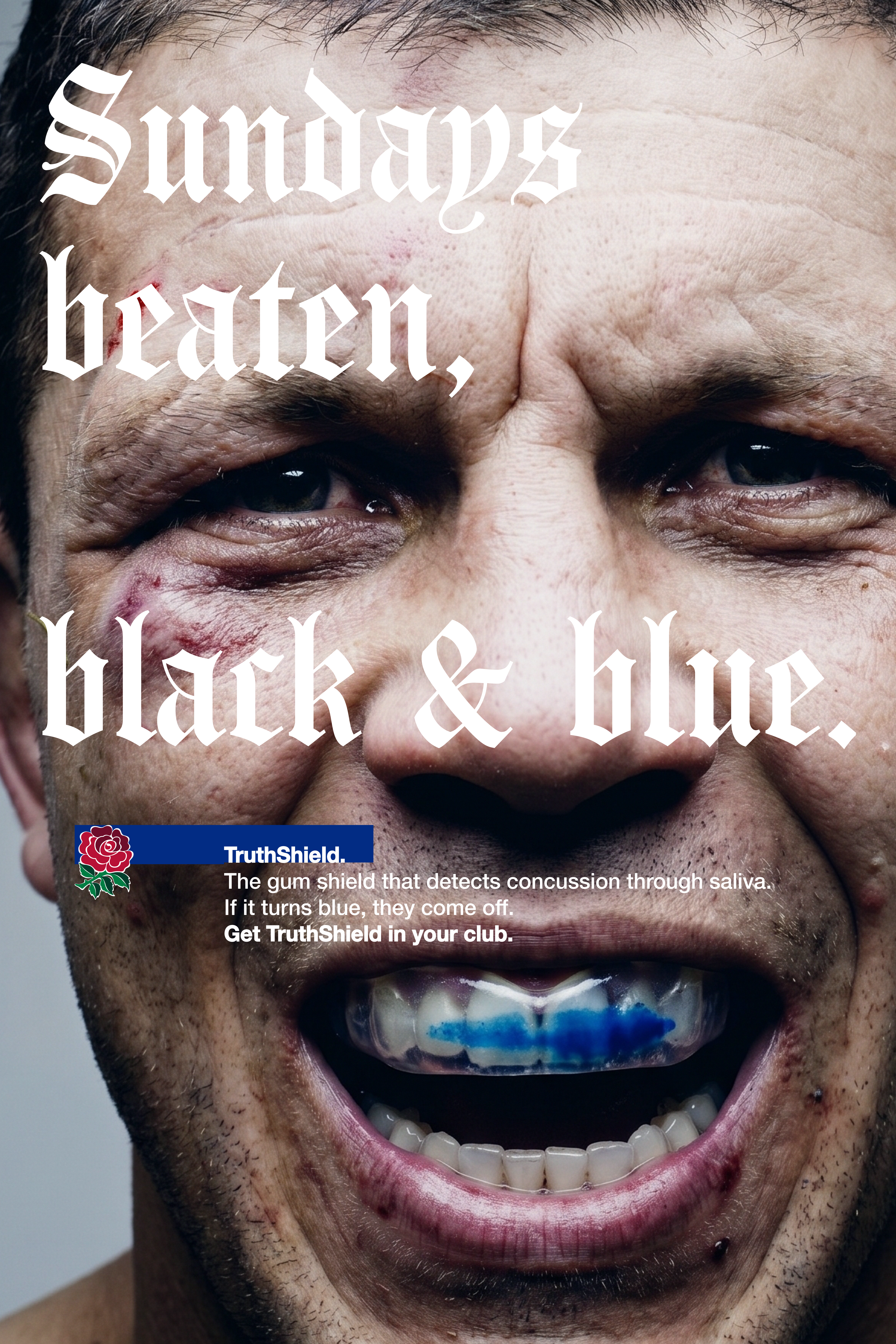 RFU TruthShield poster reading Sundays beaten black and blue.